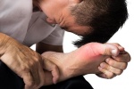 Infographic: Cảnh giác với các dấu hiệu bệnh gout