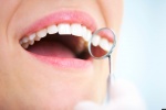 7 thói quen xấu đang phá huỷ men răng của bạn