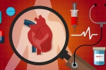Suy tim sung huyết: Dấu hiệu, yếu tố nguy cơ và cách kiểm soát bệnh