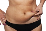 Tạng người “skinny fat”: Khi gầy không đồng nghĩa với khỏe