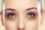 5 biện pháp tự nhiên giúp bạn tạm biệt quầng thâm và bọng mắt