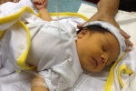 5 điều cần biết về bệnh vàng da ở trẻ sơ sinh