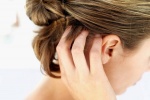 Viêm da đầu tiết bã gây ngứa ngáy, khó chịu phải làm sao?