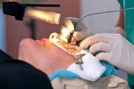 Phẫu thuật mắt bằng laser có những rủi ro gì?