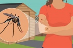 Chống muỗi đốt tự nhiên: Đừng ăn nhiều 4 thực phẩm sau