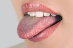 Màu lưỡi tiết lộ gì về sức khỏe của bạn?