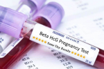 Muốn biết có thai không, thai bao nhiêu tuần: Xem bảng chỉ số beta hCG