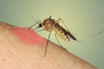 13 cách làm dịu vết muỗi đốt không cần dùng hóa chất