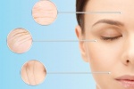 10 cách đơn giản giảm nếp nhăn trên da mặt hiệu quả 