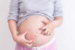 Bà bầu bị ngứa trong thai kỳ: Đâu là nguyên nhân?