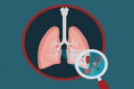 4 dưỡng chất giúp ngăn ngừa bệnh viêm phổi