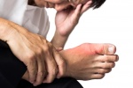 Đau nhức bàn chân nhưng không sưng có phải là gout?