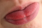 Nguyên nhân nào gây viêm, nhiệt lưỡi?