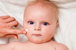 Cách điều trị viêm da cơ địa an toàn cho trẻ sơ sinh?