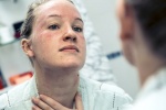 7 cách giúp bạn đối phó với eczema trên mặt