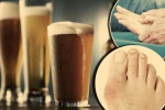 Uống bia có làm tăng nguy cơ mắc bệnh gout?
