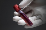 Xét nghiệm máu mới giúp phát hiện nguy cơ tiền sản giật và sinh non
