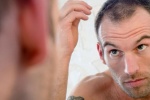 Mẹo ngăn ngừa rụng tóc và hói đầu ở nam giới