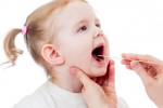 Trẻ bị viêm amidan: Những nguyên nhân và dấu hiệu điển hình 