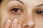 5 điều bạn nên làm để bảo vệ mắt