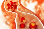 “Giải oan” cho cholesterol: Cholesterol không phải nguyên nhân gây bệnh tim mạch
