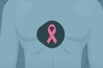 Phát hiện ung thư vú ở nam giới như thế nào?