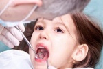 Trẻ bị viêm họng liên cầu khuẩn có cần uống thuốc kháng sinh?