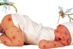 Trẻ 5 tháng tuổi có nên dùng thuốc chống muỗi, côn trùng chứa DEET không? 