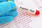 Có cần xét nghiệm H. pylori trước khi dùng thuốc điều trị bệnh dạ dày? 