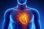 6 dấu hiệu cho thấy bạn có thể bị tắc động mạch