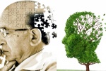 Dễ bị Alzheimer nếu mắc 10 căn bệnh sau