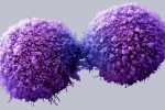 Tế bào ung thư và tế bào bình thường khác nhau thế nào?