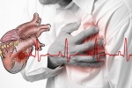 Nên dùng phương pháp chụp mạch vành nào để chẩn đoán thiếu máu cơ tim?
