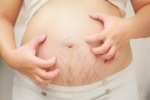 6 cách giúp mẹ bầu giảm ngứa khi mang thai
