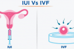 IUI và IVF: Phương pháp điều trị vô sinh nào phù hợp với bạn? 