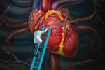 Có những phương pháp điều trị thiếu máu cơ tim nào?
