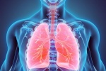 Tại sao có thể chết vì bệnh viêm phổi? 