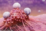 Đột phá: Truyền tế bào miễn dịch vào người bệnh để điều trị ung thư
