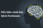 11 dấu hiệu giúp bạn nhận biết sớm bệnh Parkinson