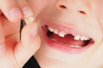 Sốc: Độ mỏng của men răng sữa giúp phát hiện sớm bệnh trầm cảm