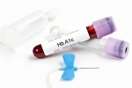 Mọi điều người bệnh đái tháo đường cần biết về xét nghiệm HbA1c