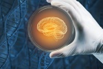 Bệnh Parkinson: Phương pháp tế bào gốc giúp phục hồi tổn thương não bộ