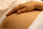 6 lợi ích của châm cứu khi mang thai: Mọi bà bầu nên biết