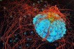 Phát hiện mới về cách ngặn chặn tế bào ung thư di căn