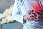 Ô nhiễm không khí có thể làm tăng nguy cơ xơ vữa động mạch