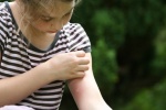8 biện pháp tự nhiên giúp giảm ngứa, giảm đau khi bị côn trùng đốt