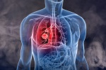 7 dấu hiệu của bệnh ung thư phổi không thể bỏ qua