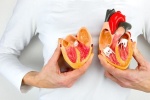 Cảnh báo: Hơn 90% người bệnh suy tim chưa có lối sống lành mạnh