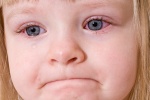 Trẻ nhỏ bị viêm kết mạc có phải dùng kháng sinh không?
