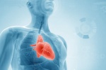 Thiếu máu cơ tim là gì, có triệu chứng gì cảnh báo?